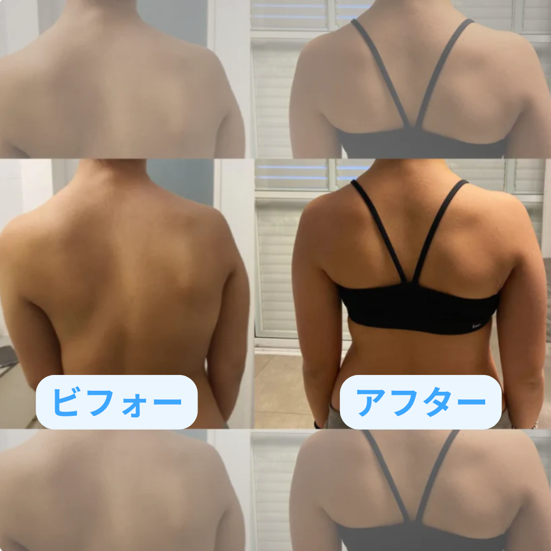 アネズ™ 姿勢ロック