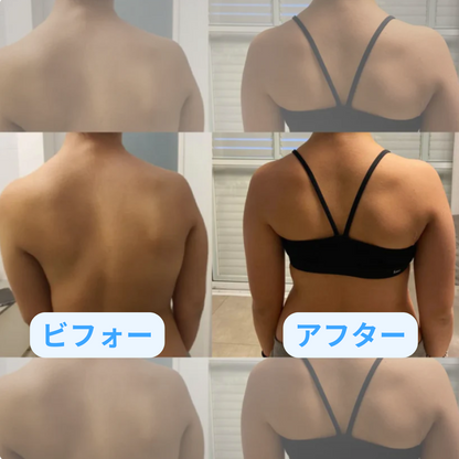 アネズ™ 姿勢ロック